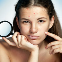 Acne Clearing Program - Virtual